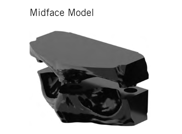 Modus 2 Midface Model